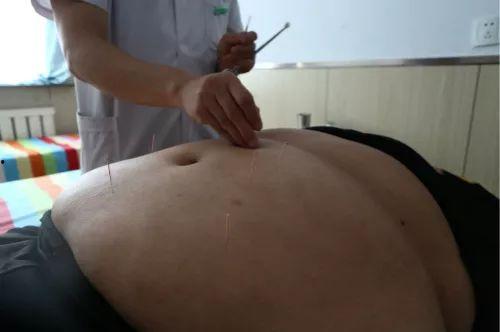 埋线减肥视频,跟随视频轻松掌握健康瘦身技巧