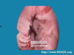 通卵管视频,视频揭秘女性生殖系统关键通道